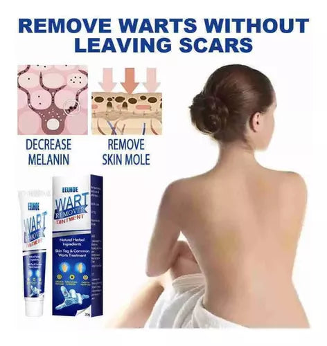 Instant Herbal Wart Remover Cream(100g)
