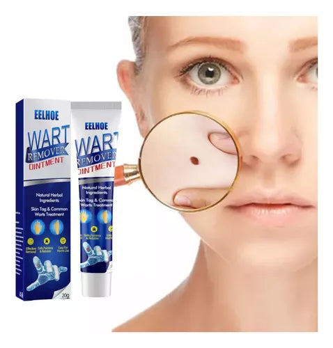 Instant Herbal Wart Remover Cream(100g)