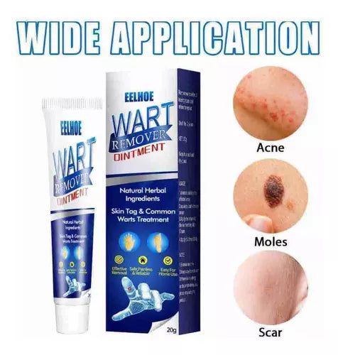 Instant Herbal Wart Remover Cream(100g)