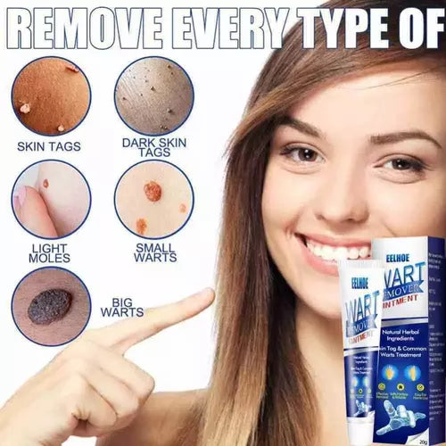 Instant Herbal Wart Remover Cream(100g)